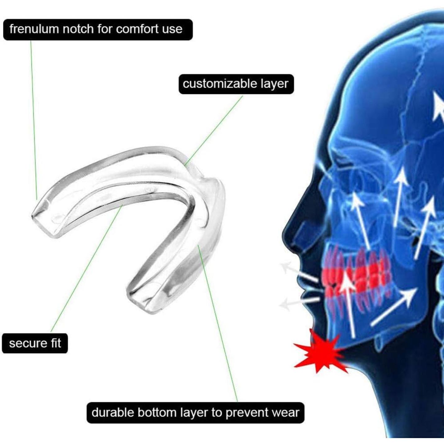 Mondbescherming Bokskauwschild Rugby 5 stuks Gumshield Volwassen Tieners Mondbeschermers voor Contact Sport Tanden Guard Sport Gebitsbeschermer Gebitsbeschermer voor Rugby Boksen Hockey MMA Karate Vechtsporten - happygetfit.com